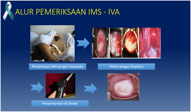 Detail Gambar Penyakit Ims Nomer 20