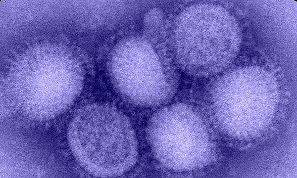 Detail Gambar Penyakit Influenza Nomer 31