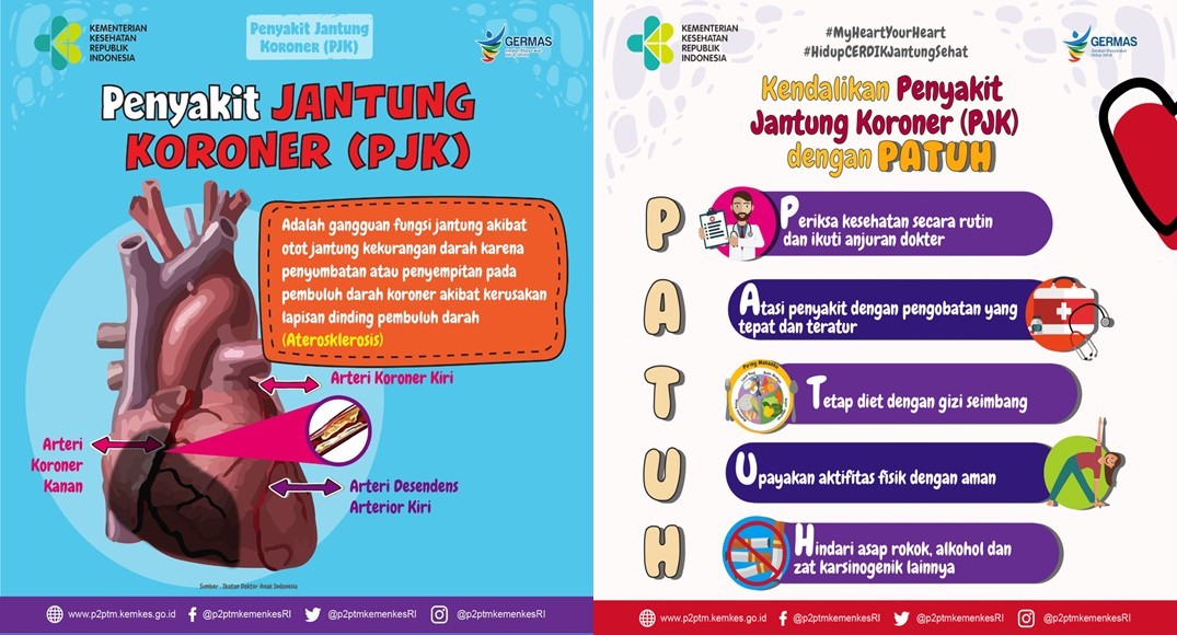 Detail Gambar Penyakit Jantung Koroner Nomer 28