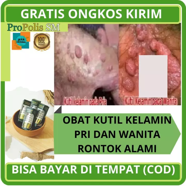 Detail Gambar Penyakit Jengger Ayam Nomer 46