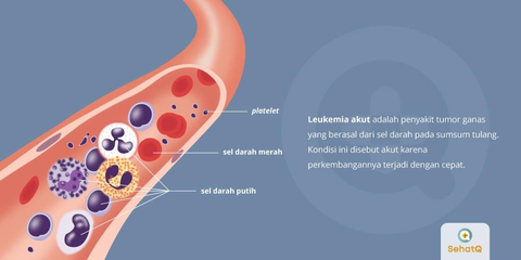 Detail Gambar Penyakit Leukemia Nomer 13