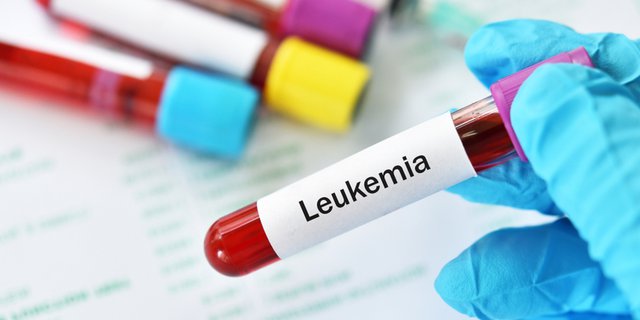 Detail Gambar Penyakit Leukemia Nomer 34