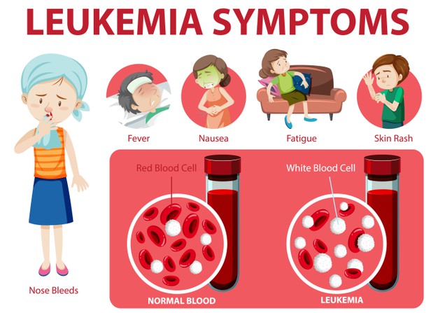 Detail Gambar Penyakit Leukimia Nomer 9