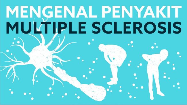 Detail Gambar Penyakit Multiple Sclerosis Nomer 24