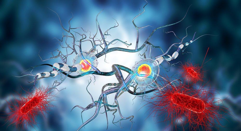 Detail Gambar Penyakit Multiple Sclerosis Nomer 4