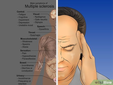 Detail Gambar Penyakit Multiple Sclerosis Nomer 42