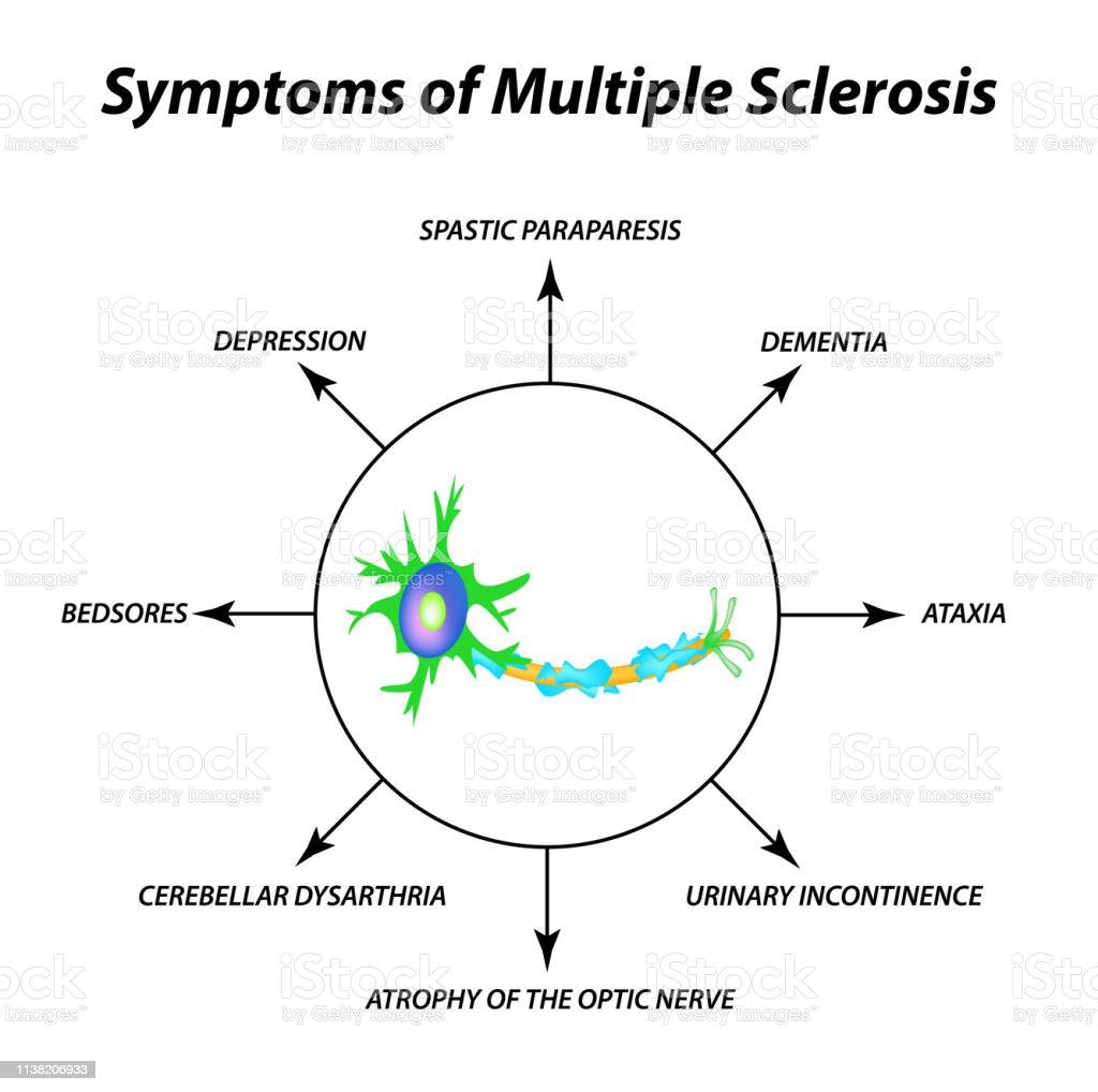 Detail Gambar Penyakit Multiple Sclerosis Nomer 44