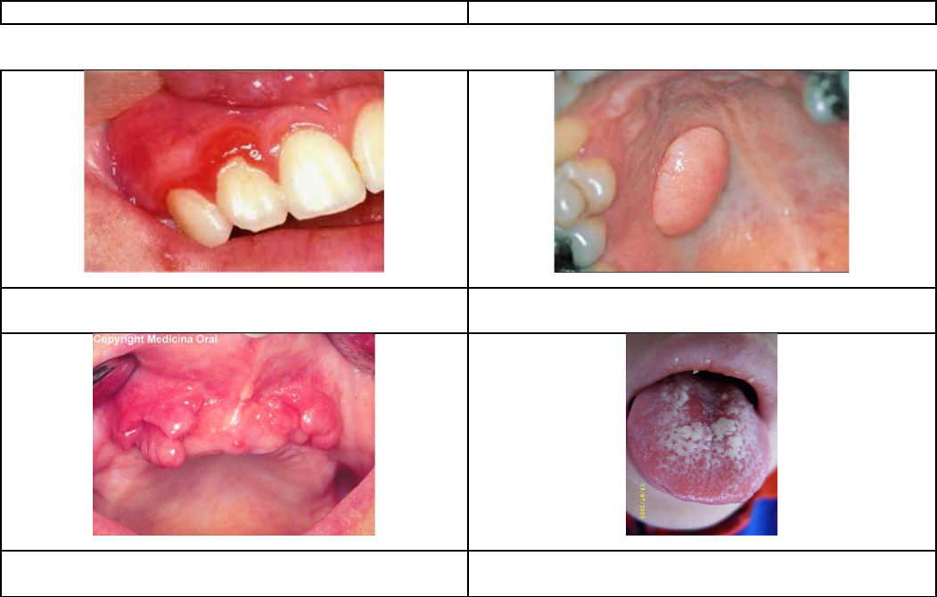 Detail Gambar Penyakit Mulut Nomer 35