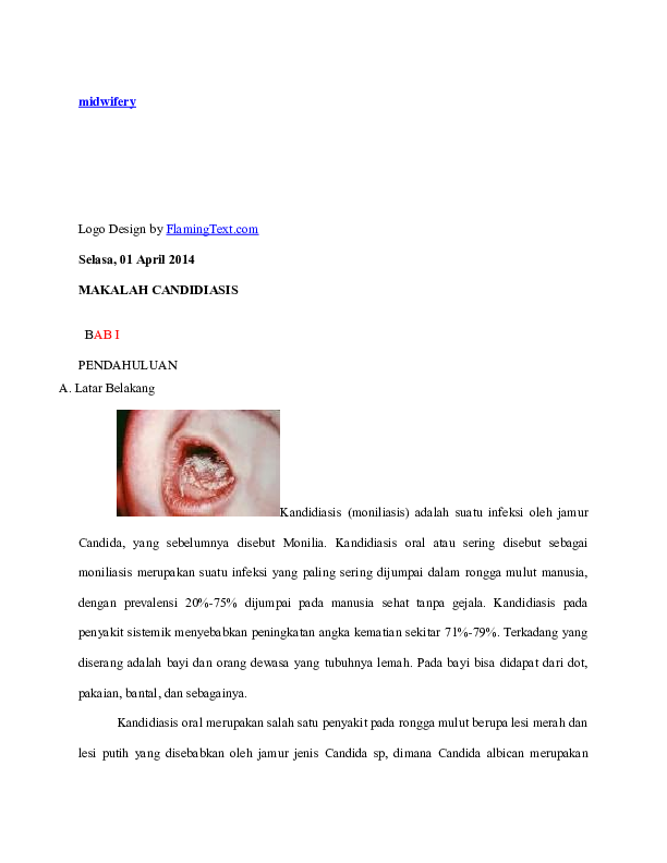 Detail Gambar Penyakit Oral Candidosis Nomer 35