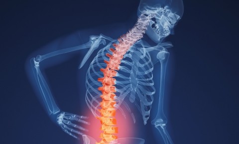 Detail Gambar Penyakit Osteoporosis Nomer 20