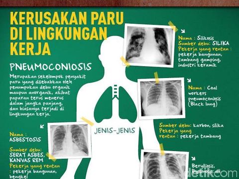 Gambar Penyakit Paru Akibat Pekerjaan - KibrisPDR