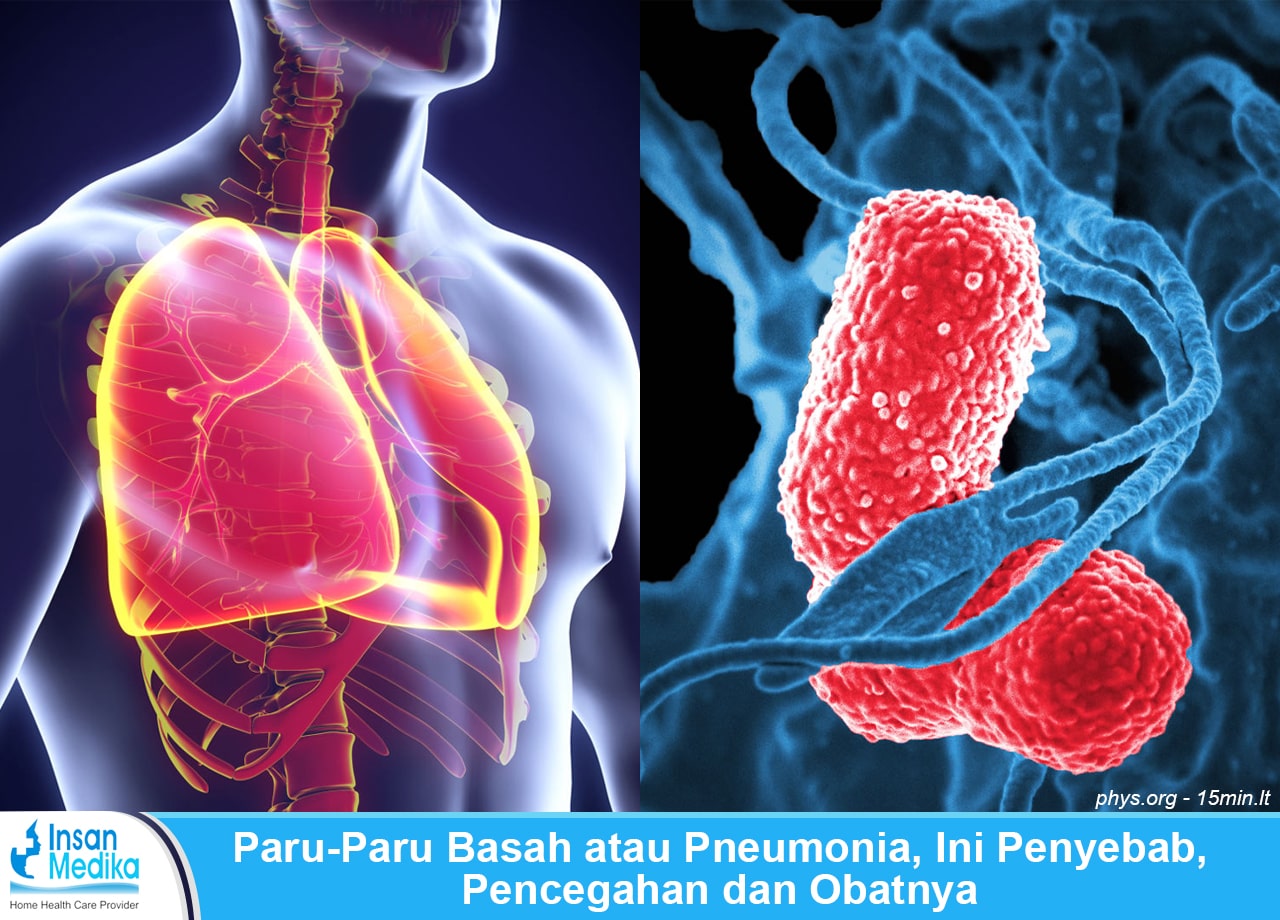 Detail Gambar Penyakit Pneumonia Nomer 17