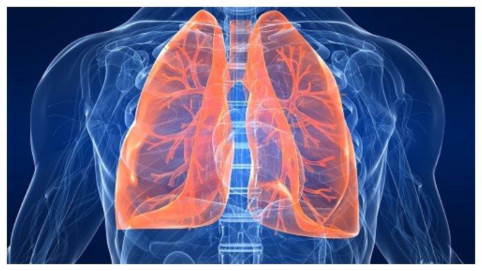 Detail Gambar Penyakit Pneumonia Nomer 20