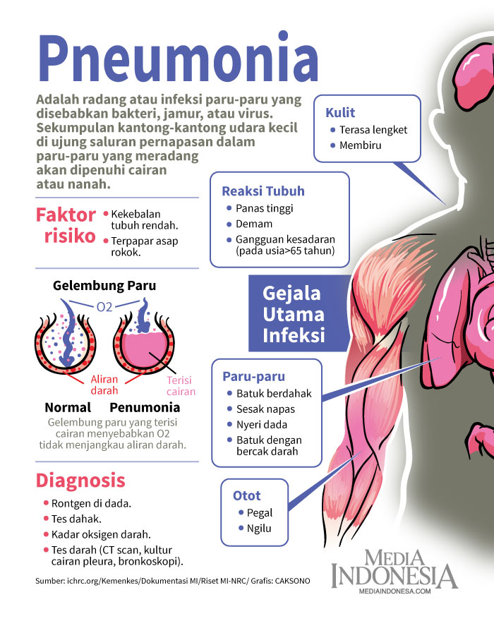 Detail Gambar Penyakit Pneumonia Nomer 31