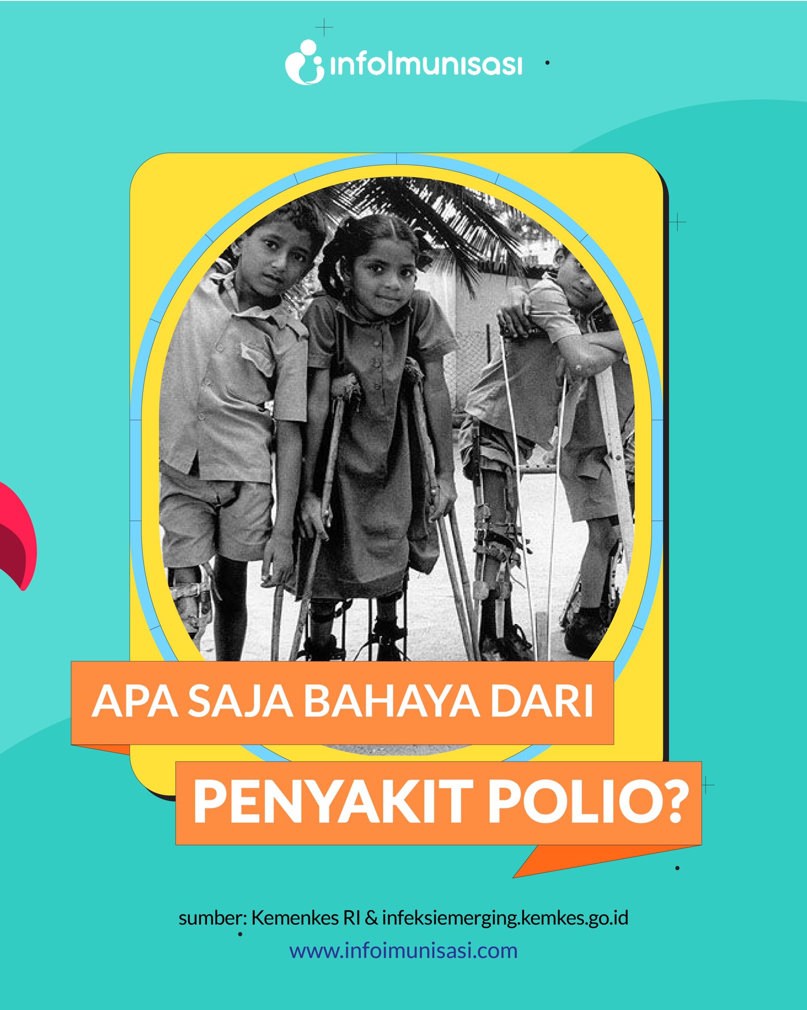 Detail Gambar Penyakit Polio Nomer 43