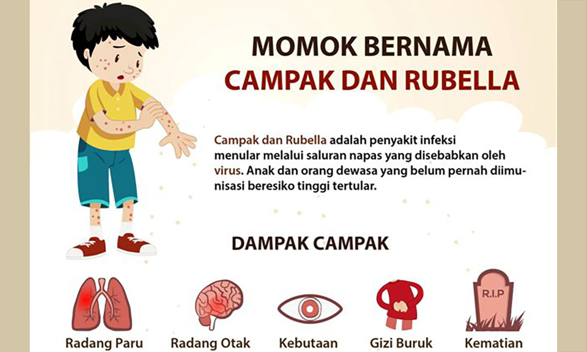 Detail Gambar Penyakit Rubella Nomer 20