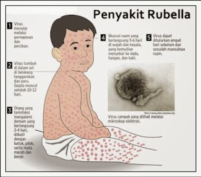 Detail Gambar Penyakit Rubella Nomer 21