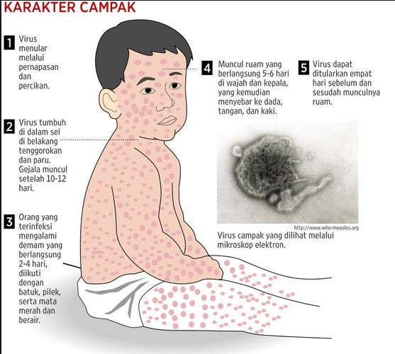 Detail Gambar Penyakit Rubella Nomer 24