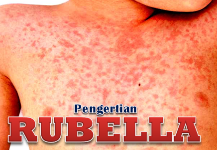 Detail Gambar Penyakit Rubella Nomer 25