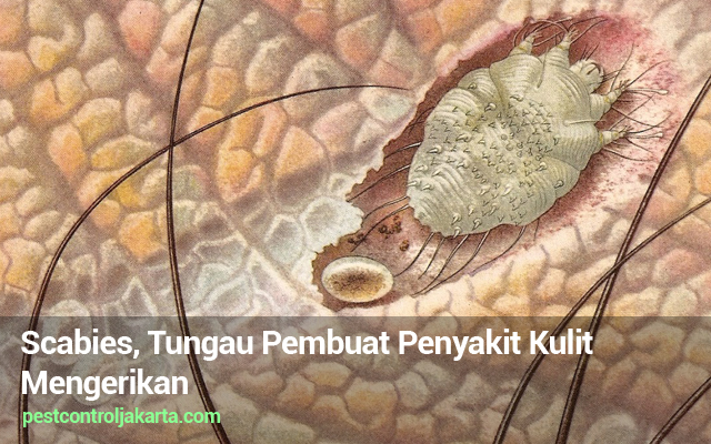 Detail Gambar Penyakit Scabies Nomer 15