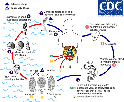 Detail Gambar Penyakit Schistosomoasis Nomer 14