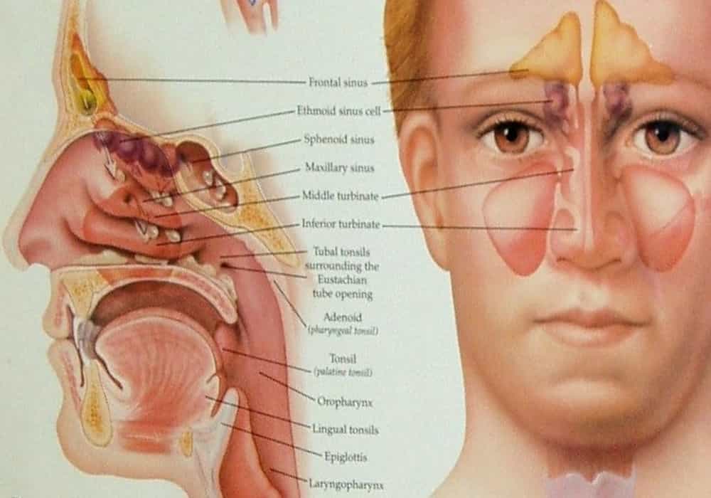 Detail Gambar Penyakit Sinusitis Nomer 38