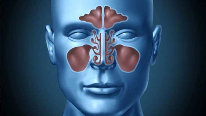 Detail Gambar Penyakit Sinusitis Nomer 41