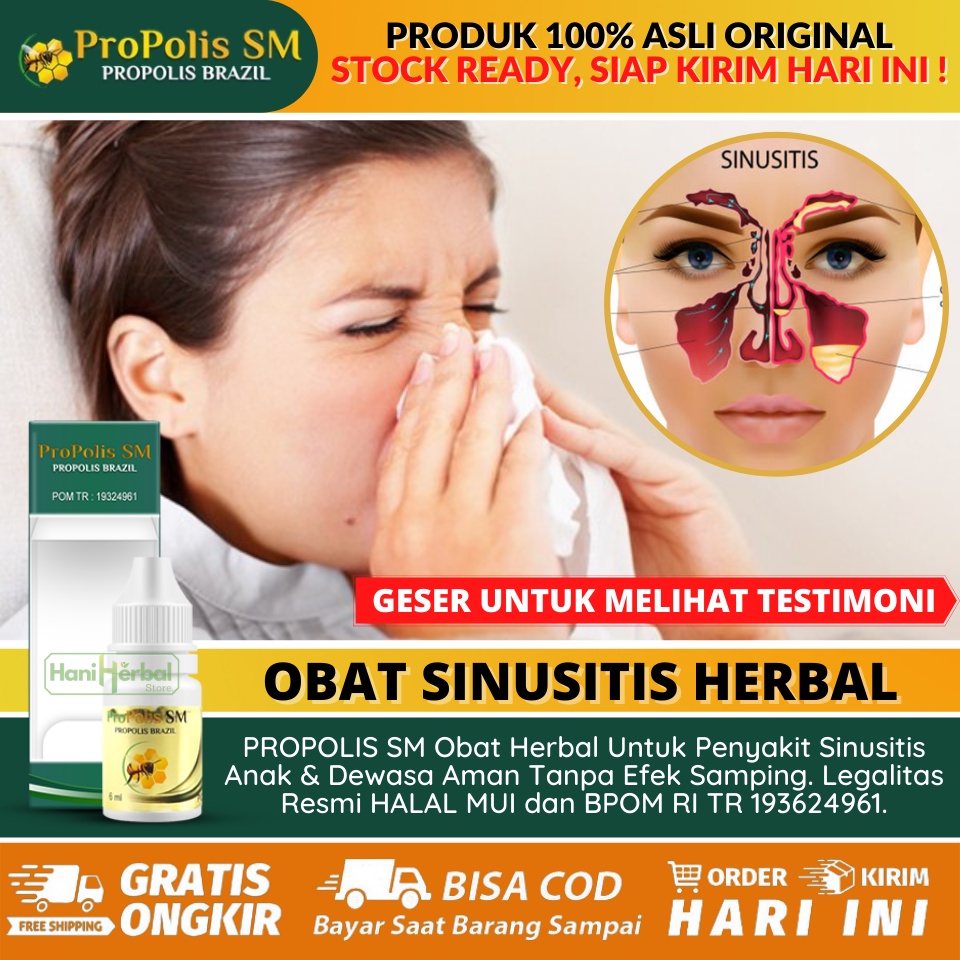 Detail Gambar Penyakit Sinusitis Nomer 50