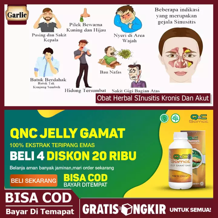 Detail Gambar Penyakit Sinusitis Nomer 53