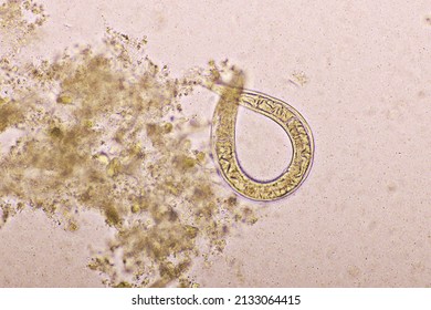 Detail Gambar Penyakit Stongiloiddia Nomer 36