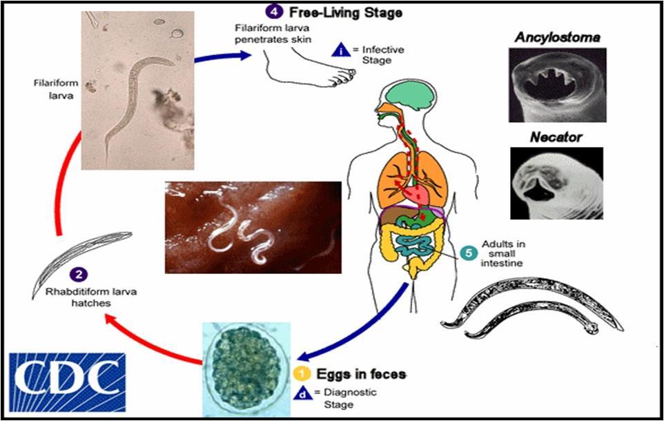 Detail Gambar Penyakit Stongiloiddia Cacing Gelang Nomer 44