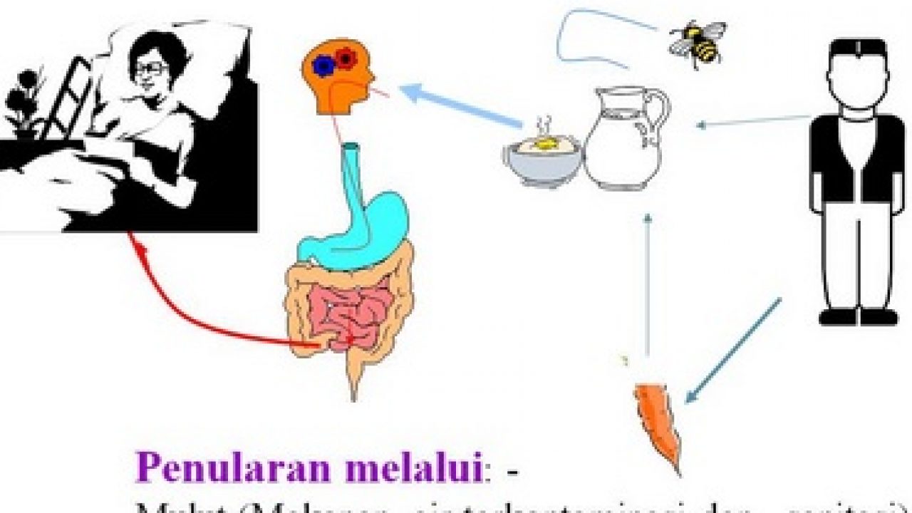 Detail Gambar Penyakit Tifus Nomer 24
