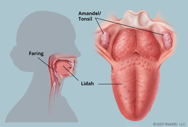 Detail Gambar Penyakit Tonsillitis Nomer 38