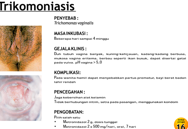 Detail Gambar Penyakit Trikomoniasis Nomer 25