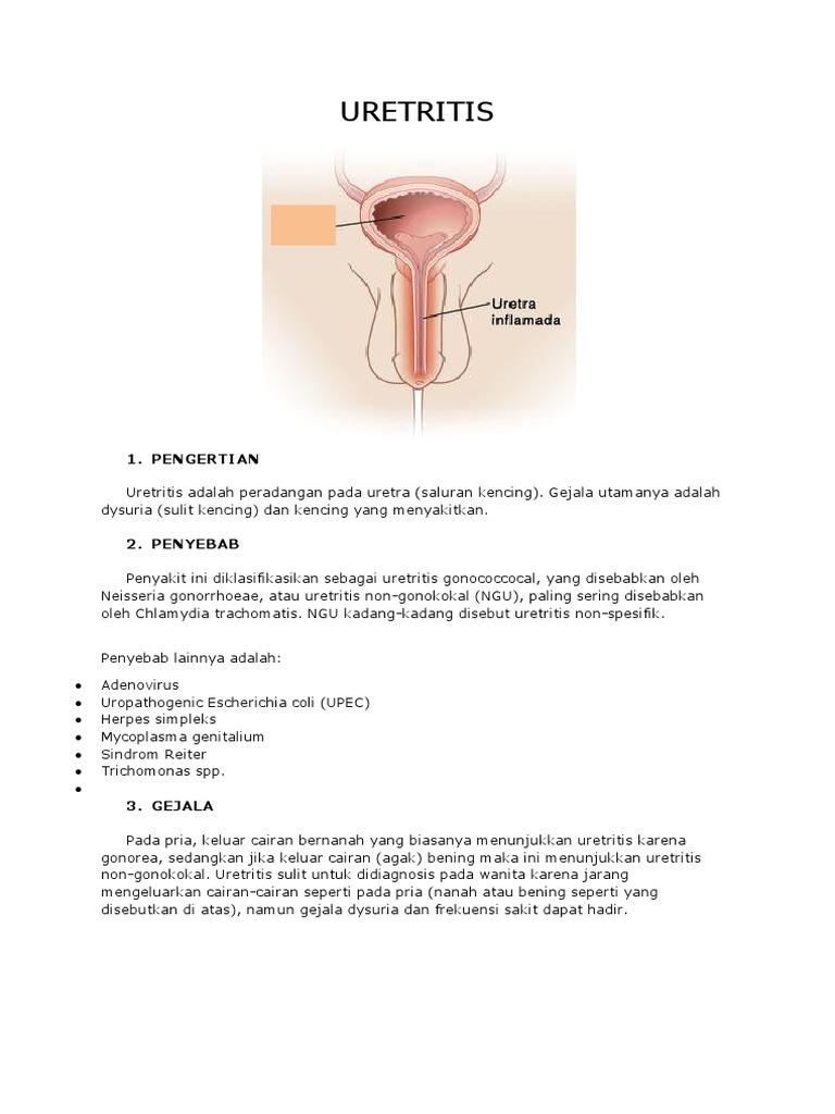 Detail Gambar Penyakit Uretritis Nomer 14