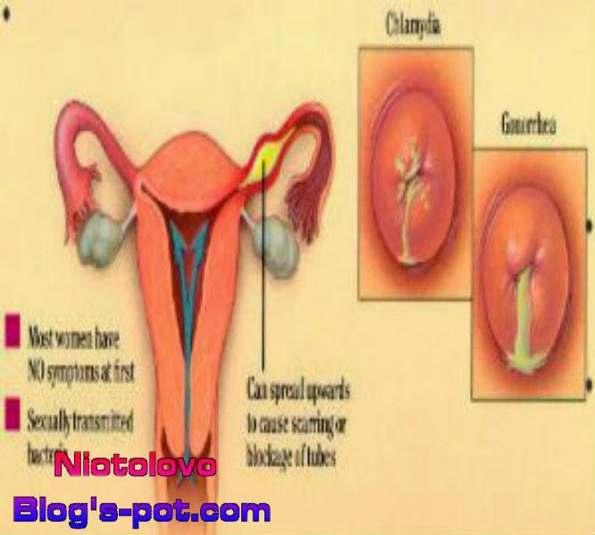 Detail Gambar Penyakit Uretritis Nomer 33