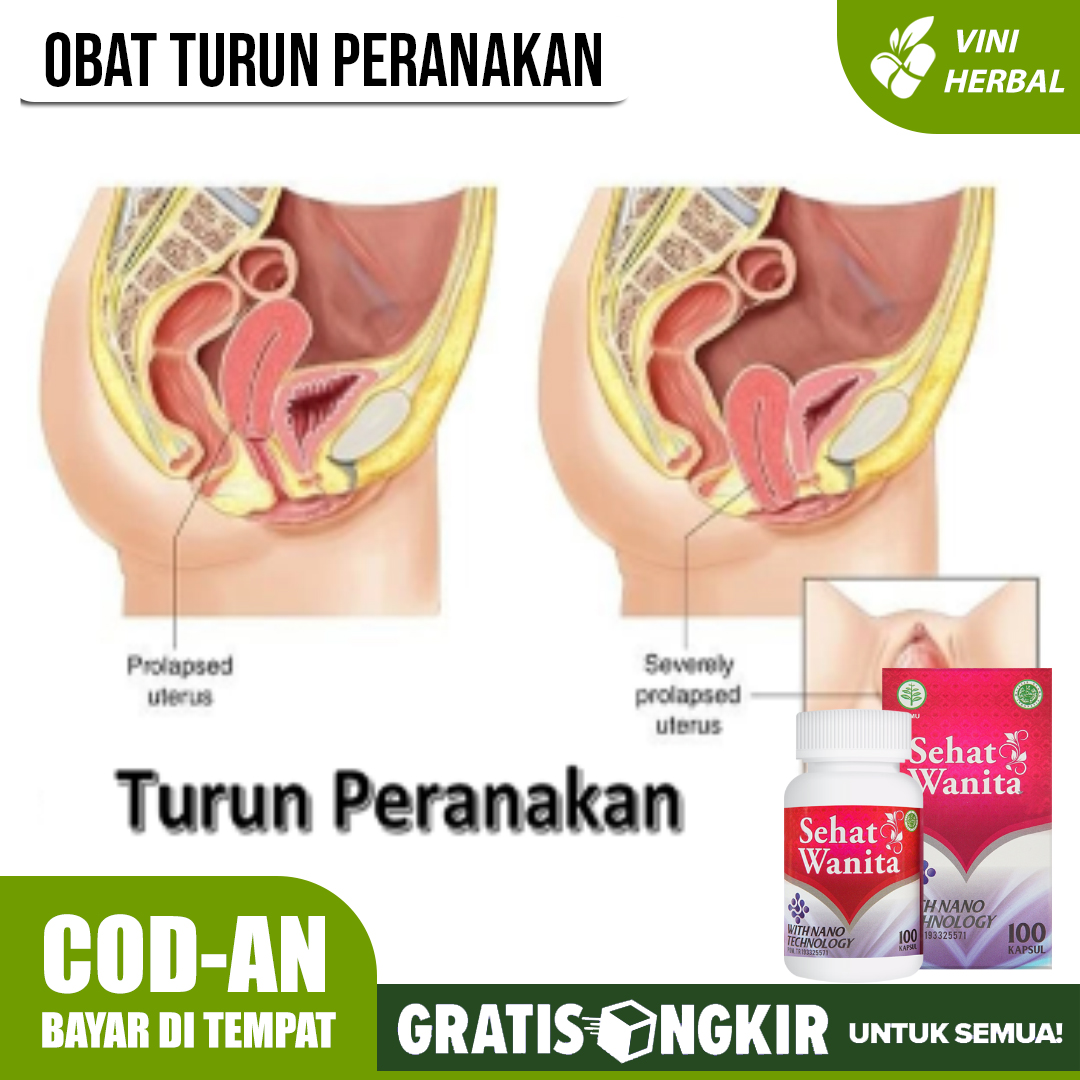 Detail Gambar Peranakan Turun Nomer 15