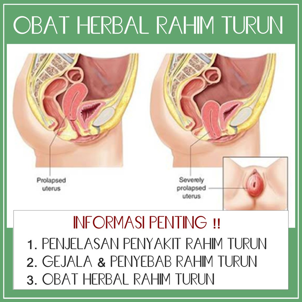 Detail Gambar Peranakan Turun Nomer 35