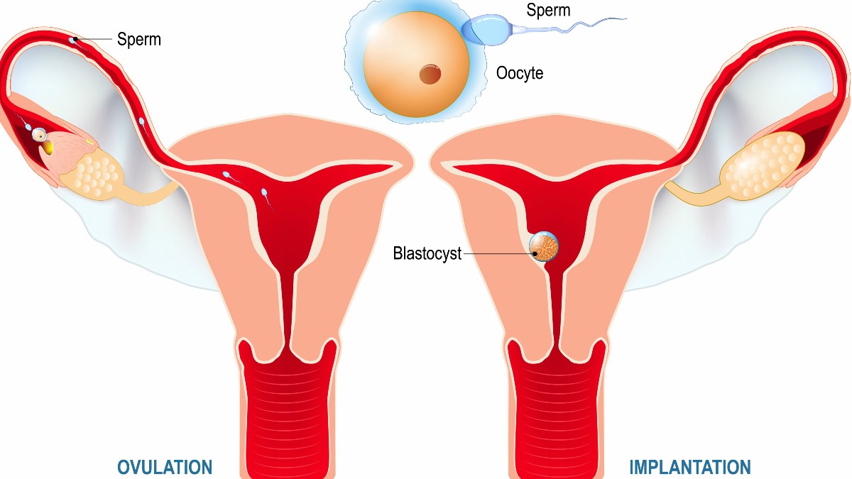 Detail Contoh Tanda Tanda Akan Menstruasi Nomer 29