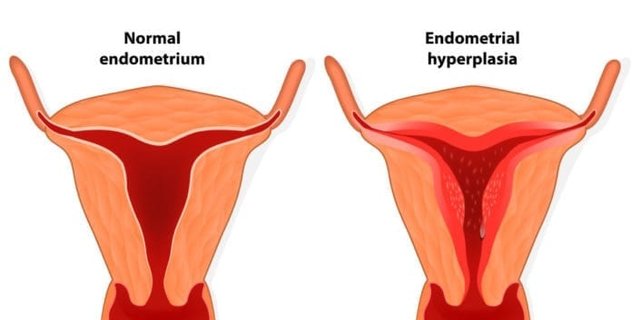 Detail Contoh Tanda Tanda Akan Menstruasi Nomer 43