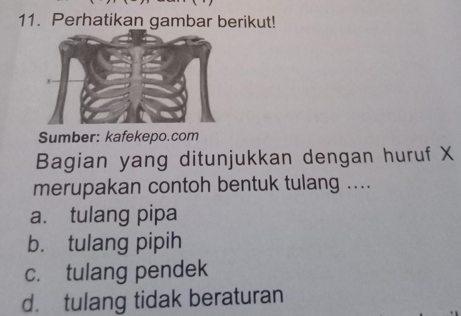 Detail Contoh Tulang Tak Beraturan Nomer 15