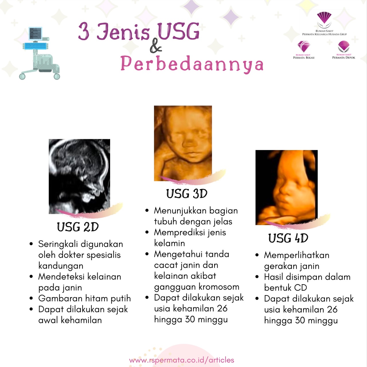 Detail Contoh Usg 4d Nomer 43