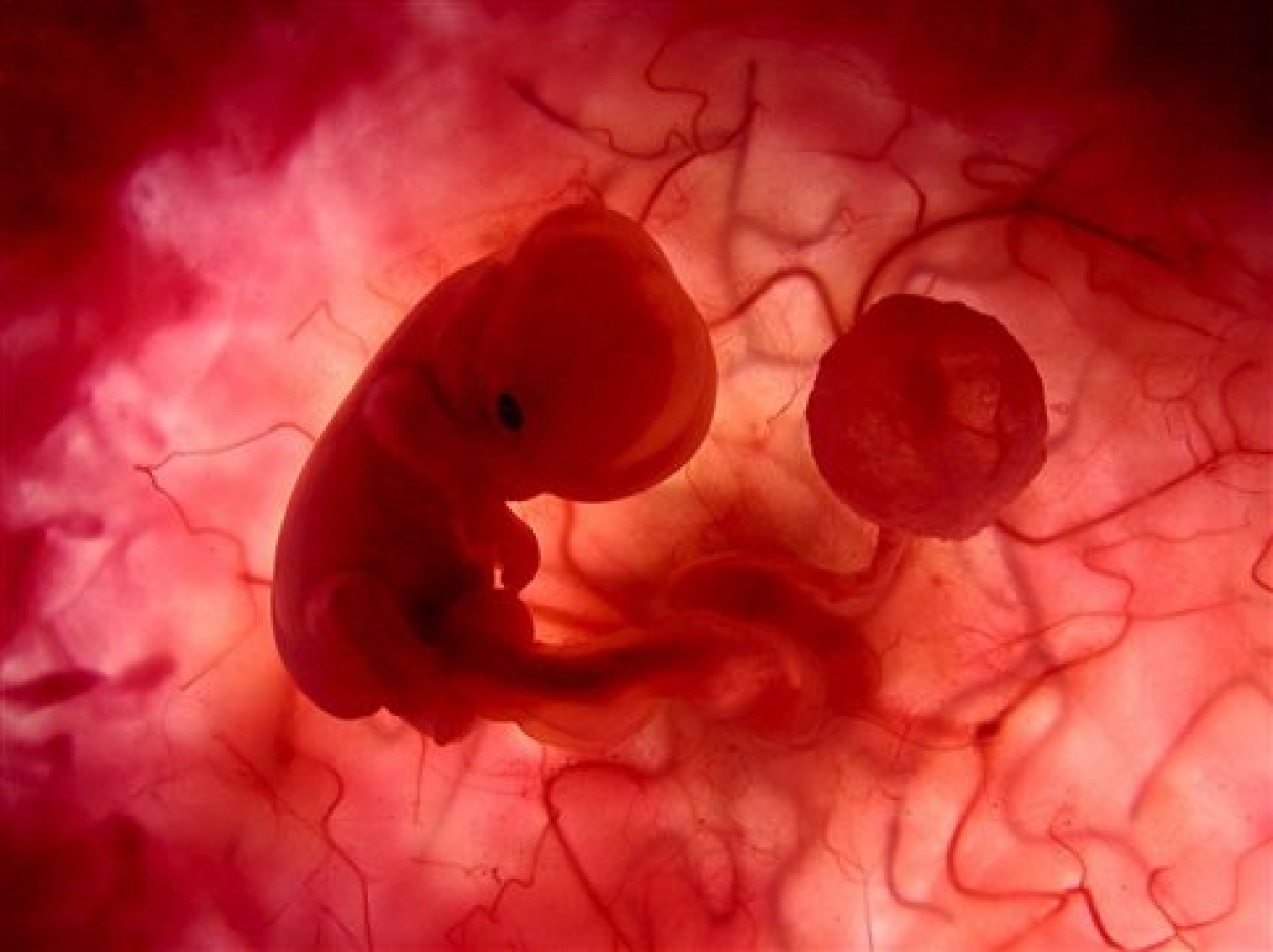Detail Gambar Perkembangan Embrio Nomer 17