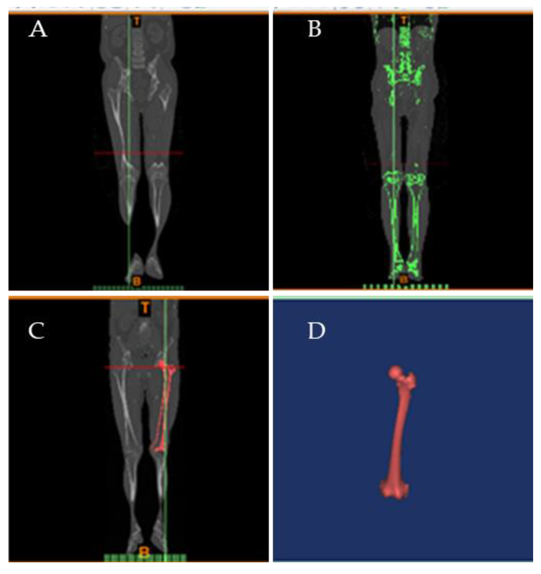 Detail Femur Anatomie Nomer 19