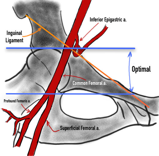 Detail Femur Anatomie Nomer 4