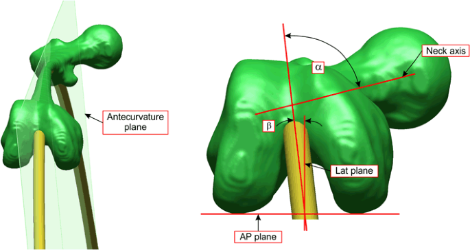 Detail Femur Anatomie Nomer 6