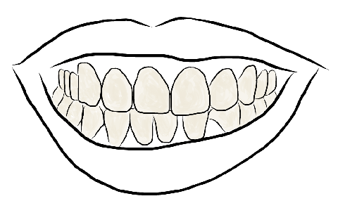 Detail Veneers Bilder Nomer 14
