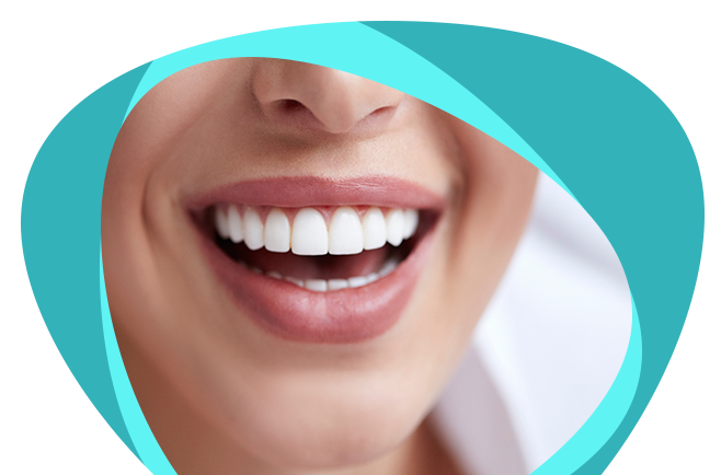 Detail Veneers Bilder Nomer 19