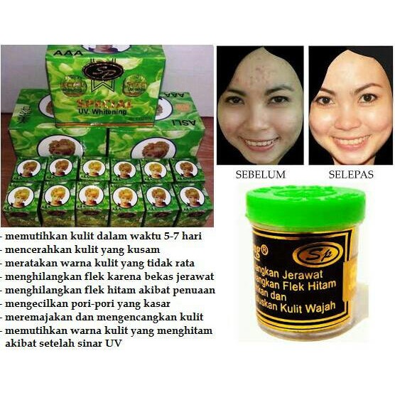 Detail Cream Sp Tutup Hijau Nomer 27