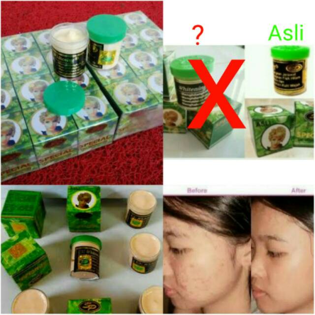 Detail Cream Sp Tutup Hijau Nomer 30